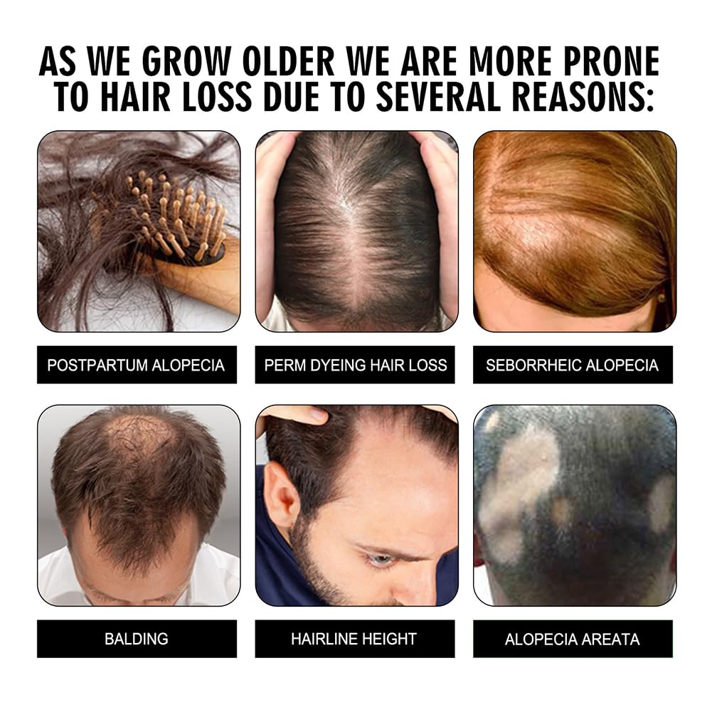 Твердий шампунь Ginger Hair Regrowth проти випадіння волосся, фото №6