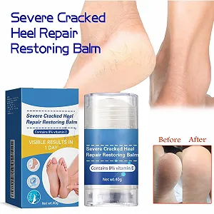 Крем для ног увлажняющий против трещин для пяток, рук и ног восстанавливающий synthetic.ua - Фото 1